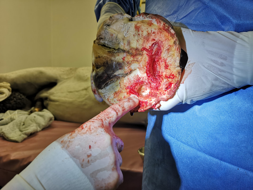 Surgery on horse with keratomas